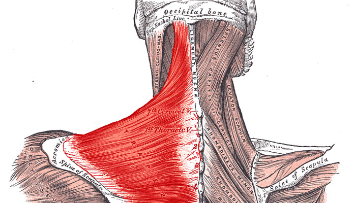 cervical strain