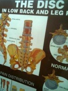 Back Pain